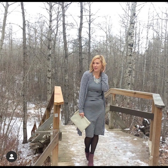Black and white stripe dress - Picture 2 of 4
